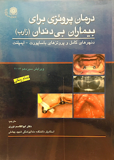 عکس درمان پروتزی برای بیماران بی  دندان (زارب) تمام رنگی